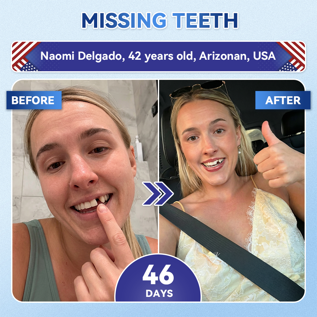 Your Smile~ Natravor® 🦷 Tideglusib Fast‑Dissolving Tooth & Gum Repair Oral Strips ✨ (𝟓-𝐢𝐧-𝟏 💎 𝐑𝐞𝐛𝐮𝐢𝐥𝐝 𝐄𝐧𝐚𝐦𝐞𝐥 & 𝐃𝐞𝐧𝐭𝐢𝐧 • 𝐒𝐭𝐫𝐞𝐧𝐠𝐭𝐡𝐞𝐧 𝐆𝐮𝐦𝐬 • 𝐄𝐫𝐚𝐝𝐢𝐜𝐚𝐭𝐞 𝐓𝐚𝐫𝐭𝐚𝐫 & 𝐎𝐝𝐨𝐫 • 𝐖𝐡𝐢𝐭𝐞𝐧𝐢𝐧𝐠 • 𝐒𝐭𝐨𝐩 𝐓𝐨𝐨𝐭𝐡 𝐒𝐞𝐧𝐬𝐢𝐭𝐢𝐯𝐢𝐭𝐲)